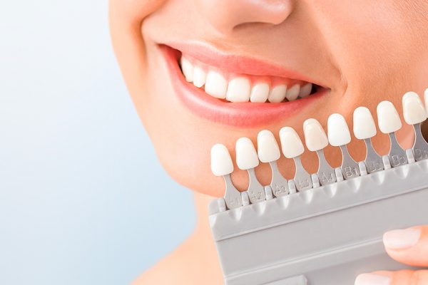 Специфика протезирования зубов CEREC