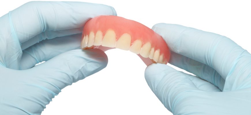 Основные виды протезов для зубов